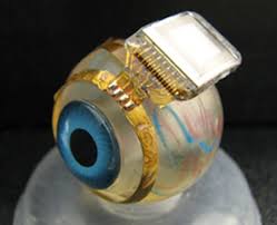 Bionic Eyes would be Given to Ten Blind Patients in England in 2017 Bionic Eyes would be Given to Ten Blind Patients in England in 2017