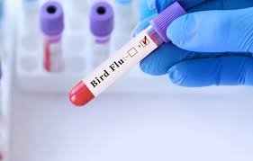First Severe Human Bird Flu Case In U.S. Highlights Growing Health Concerns; Emergency Declared First Severe Human Bird Flu Case In U.S. Highlights Growing Health Concerns; Emergency Declared