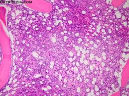 While Longer-Term Results Await, T-Cell Cancer Therapy Holds Promise