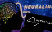 The First Ever Human Gets A Brain Chip Implant By Elon Musk's Neuralink