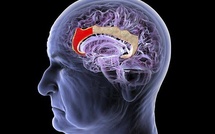 Wearable Brain Interfaces Challenge the Implant-First Future